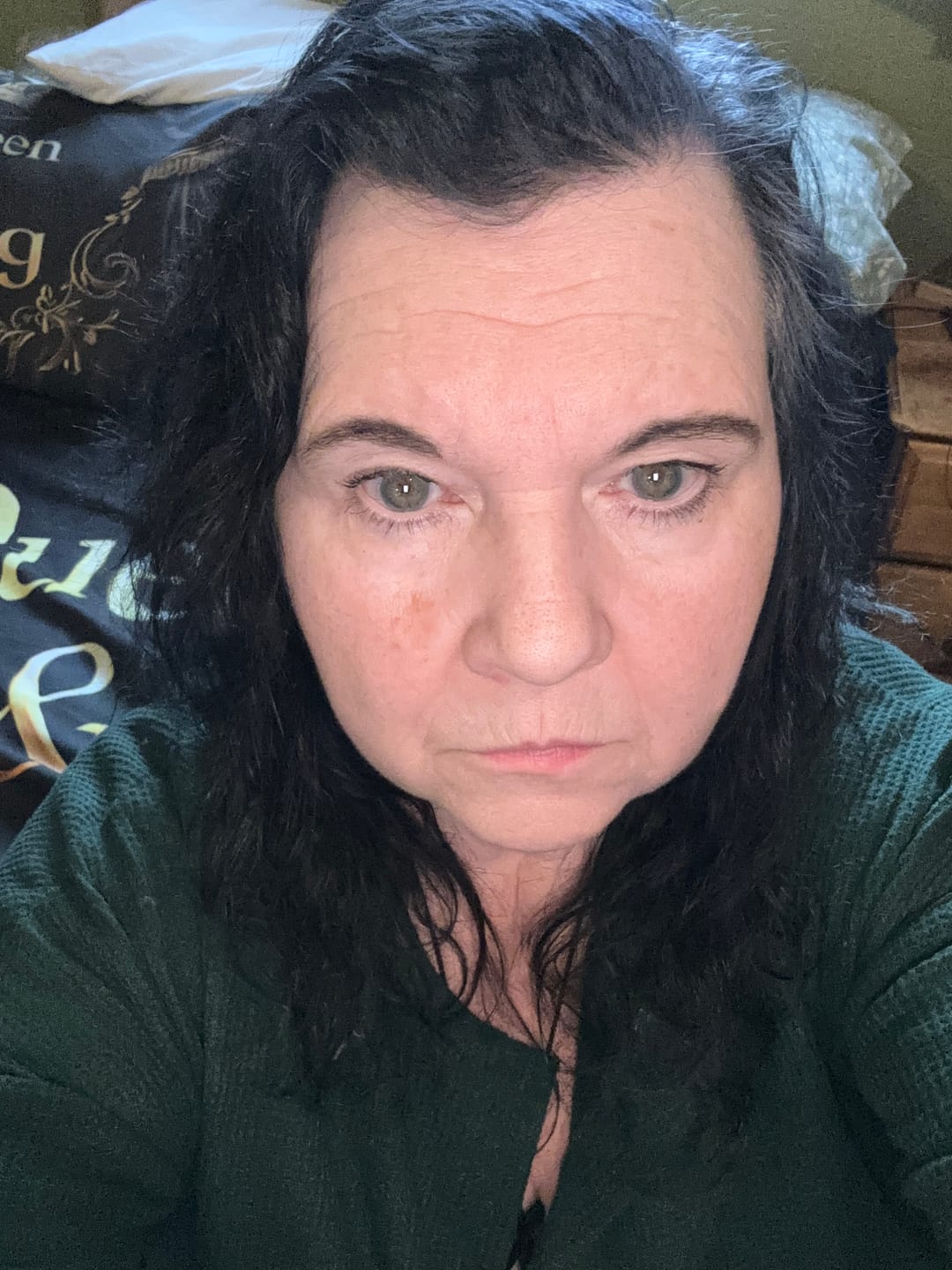 Customer photo review of Anti-Aging Cream Moisturizer for Wrinkles
