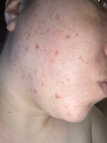 Customer photo review of Turmeric Glow Soap