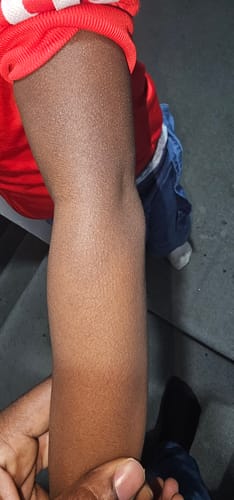 Customer photo review of Winter Body Cream (3 Pack)