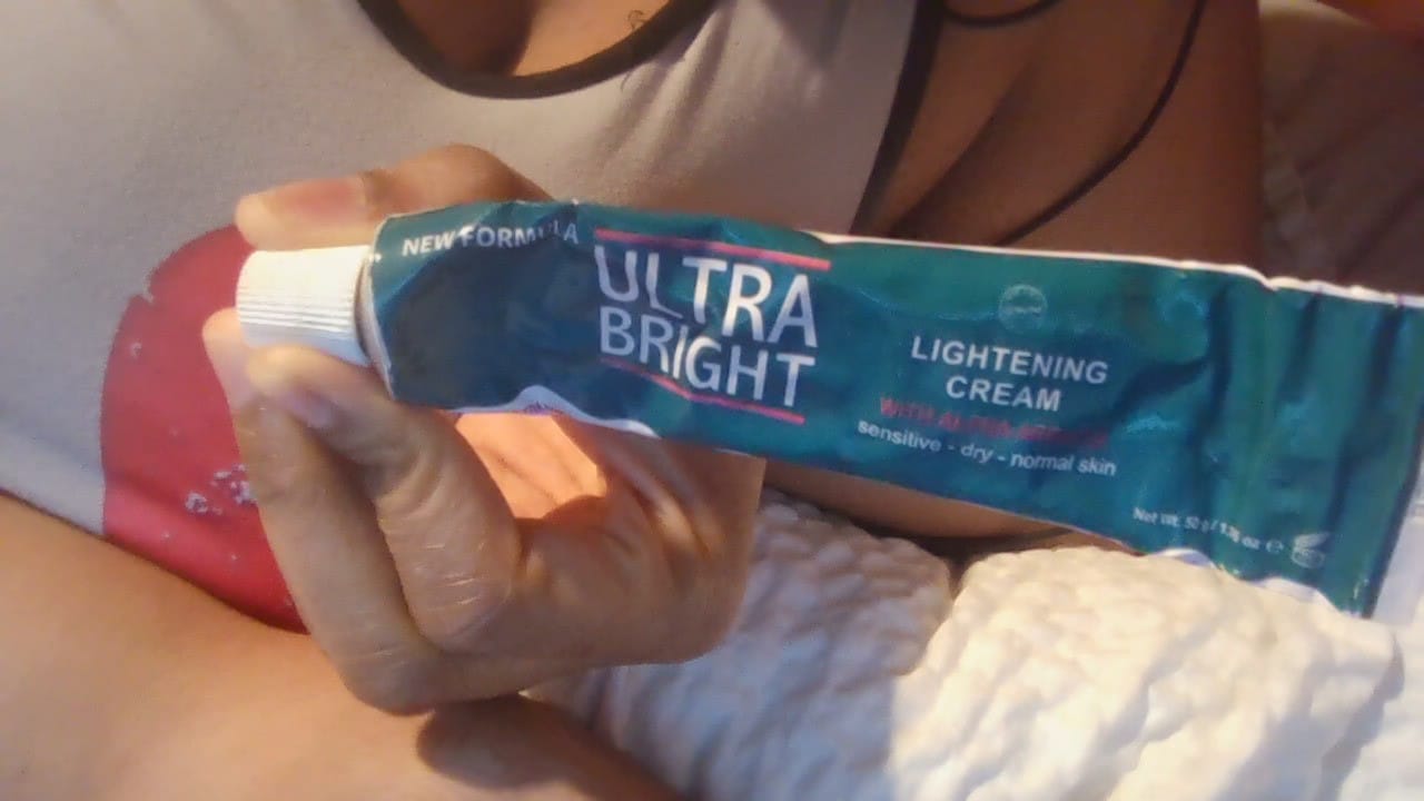 Customer photo review of Ultra Bright Lightening Cream