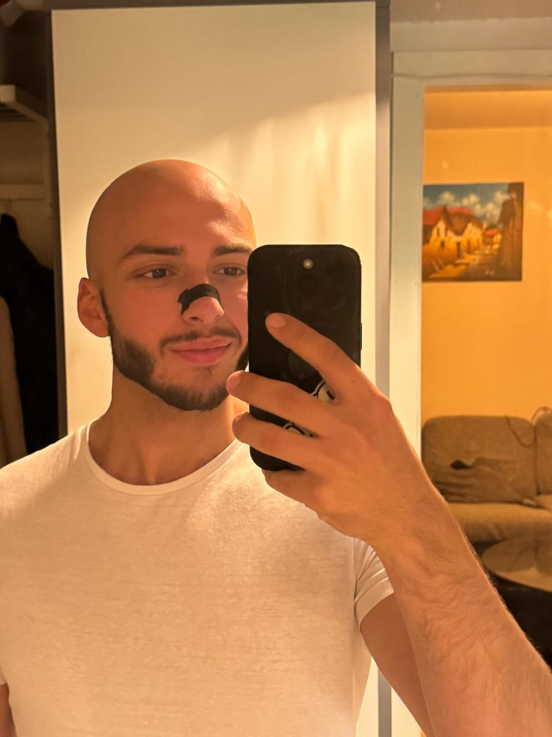Customer photo review of NASAL STRIPS | BLACK