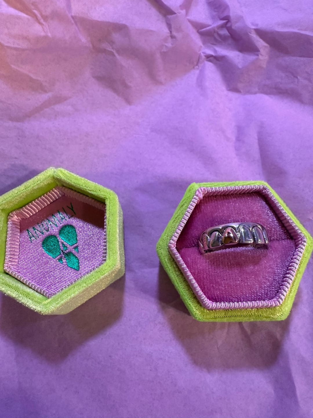 Customer photo review of Gold Tooth Ring