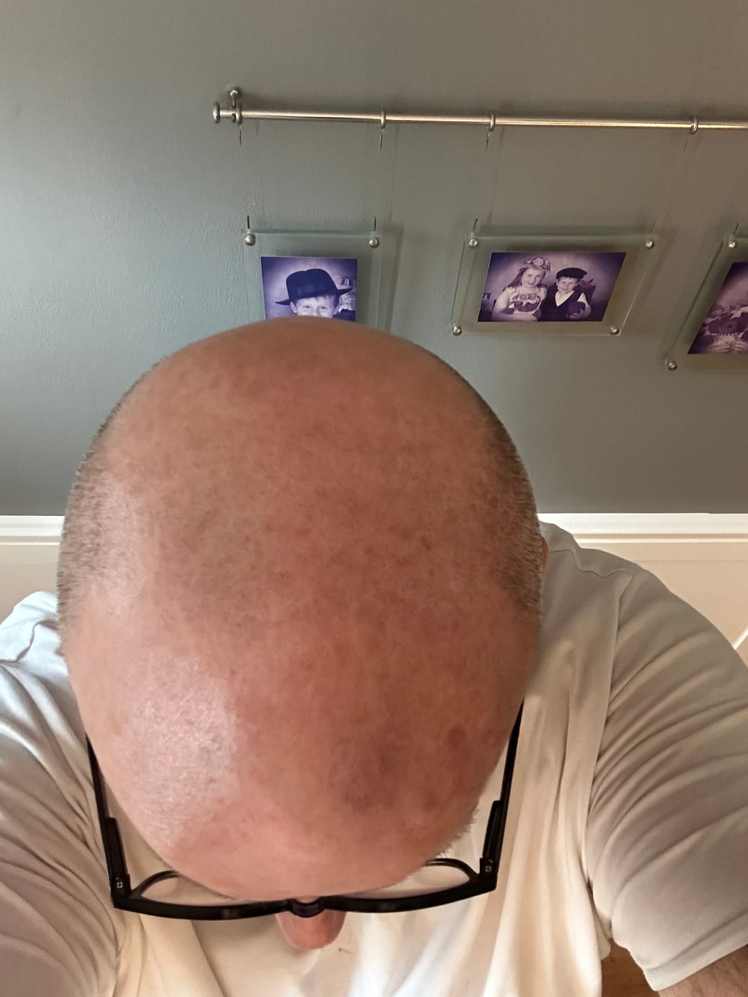 Customer photo review of Trimpod 3.0: The Ultimate Shaver for Bald Men