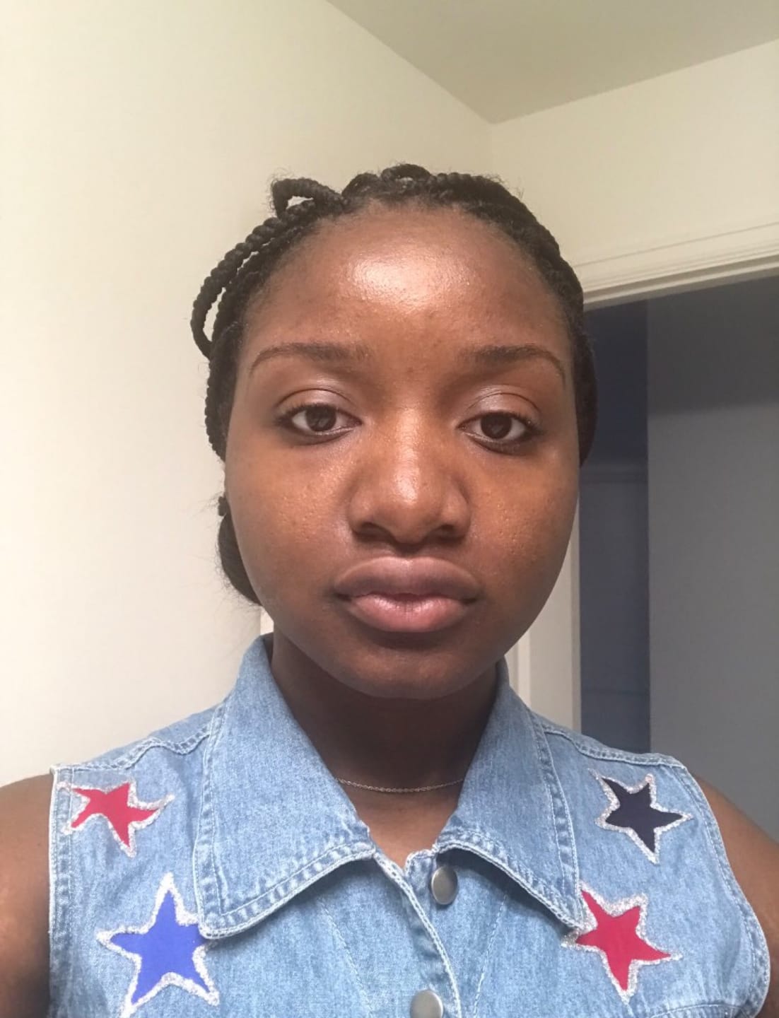 Customer photo review of Neoprosone Brightening Gel - Moisturizer Cream Gel - 30g / 1 oz