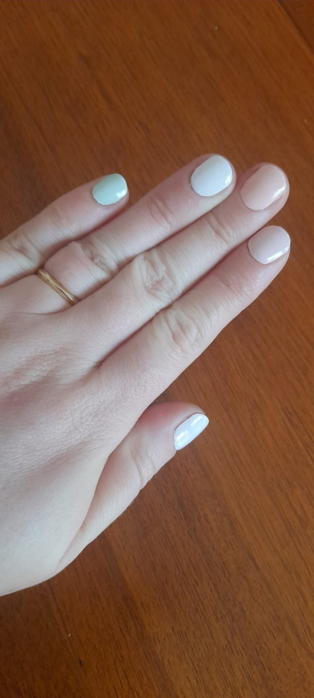 Customer photo review of Alcohol Wipes/ Prep Pads (100 pcs)