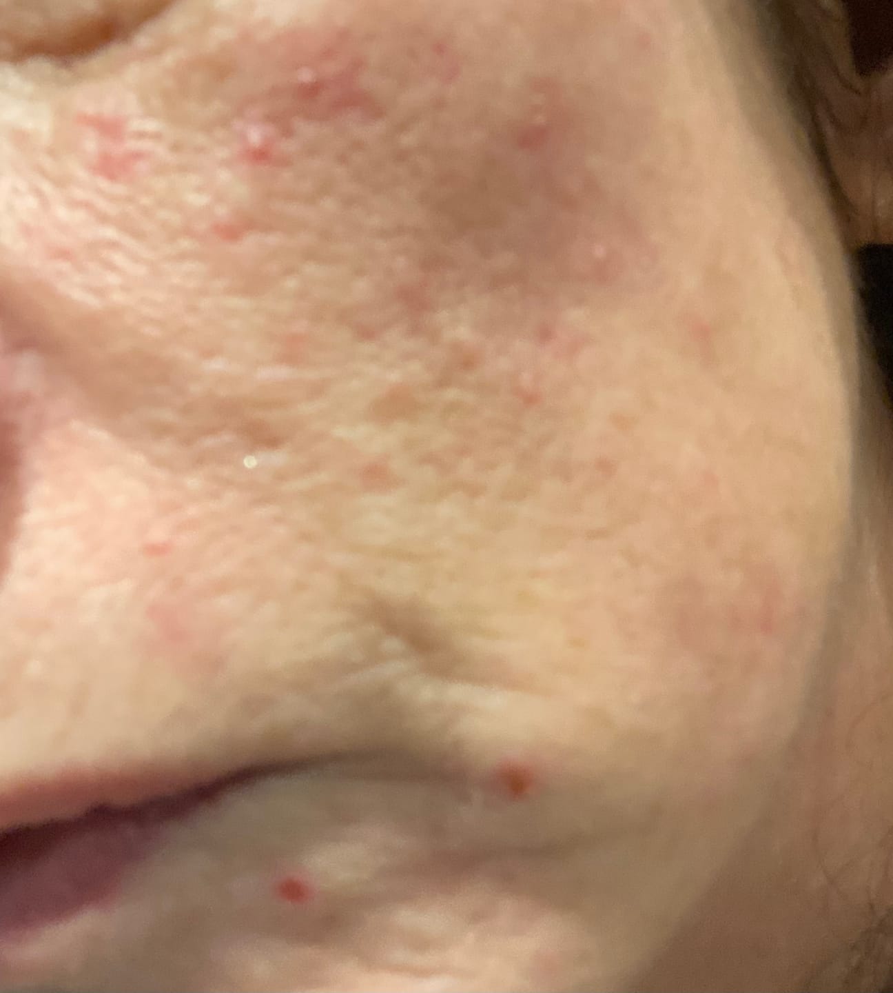 Customer photo review of The Miracle Collection
