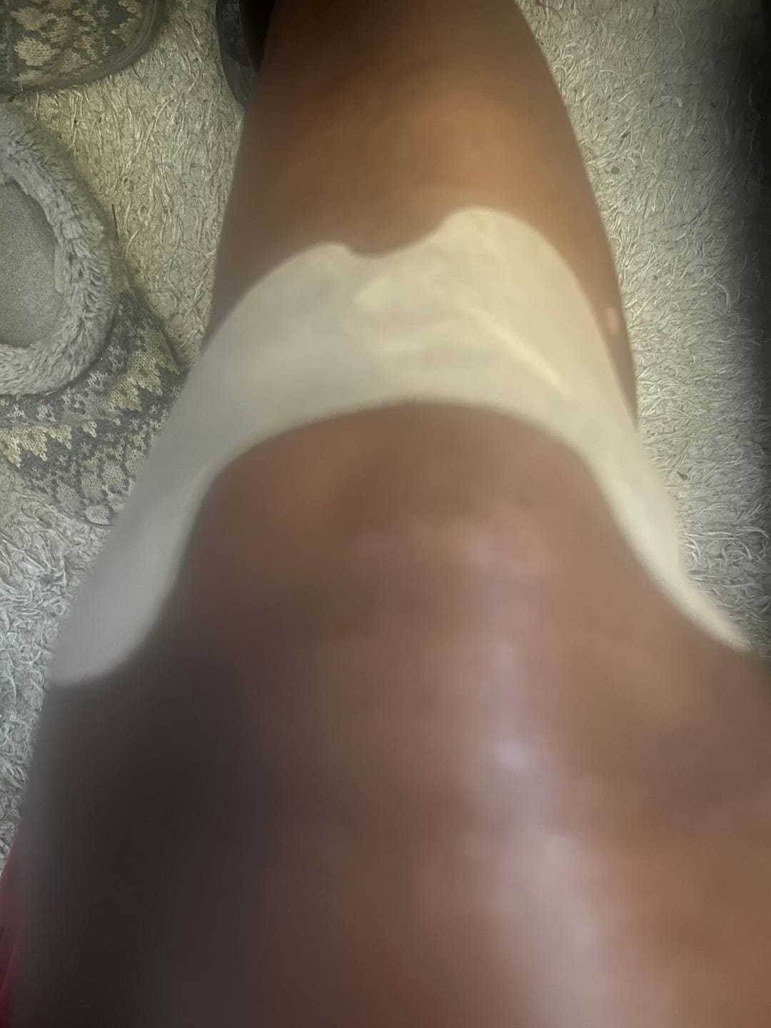 Customer photo review of Auxilium Knee Patch (fka Heaven Patch)