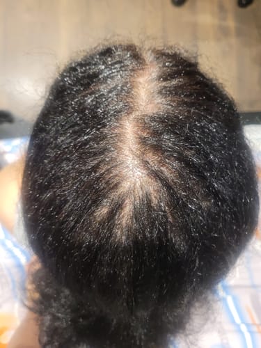 Customer photo review of Nourish & Shine Hair Oil
