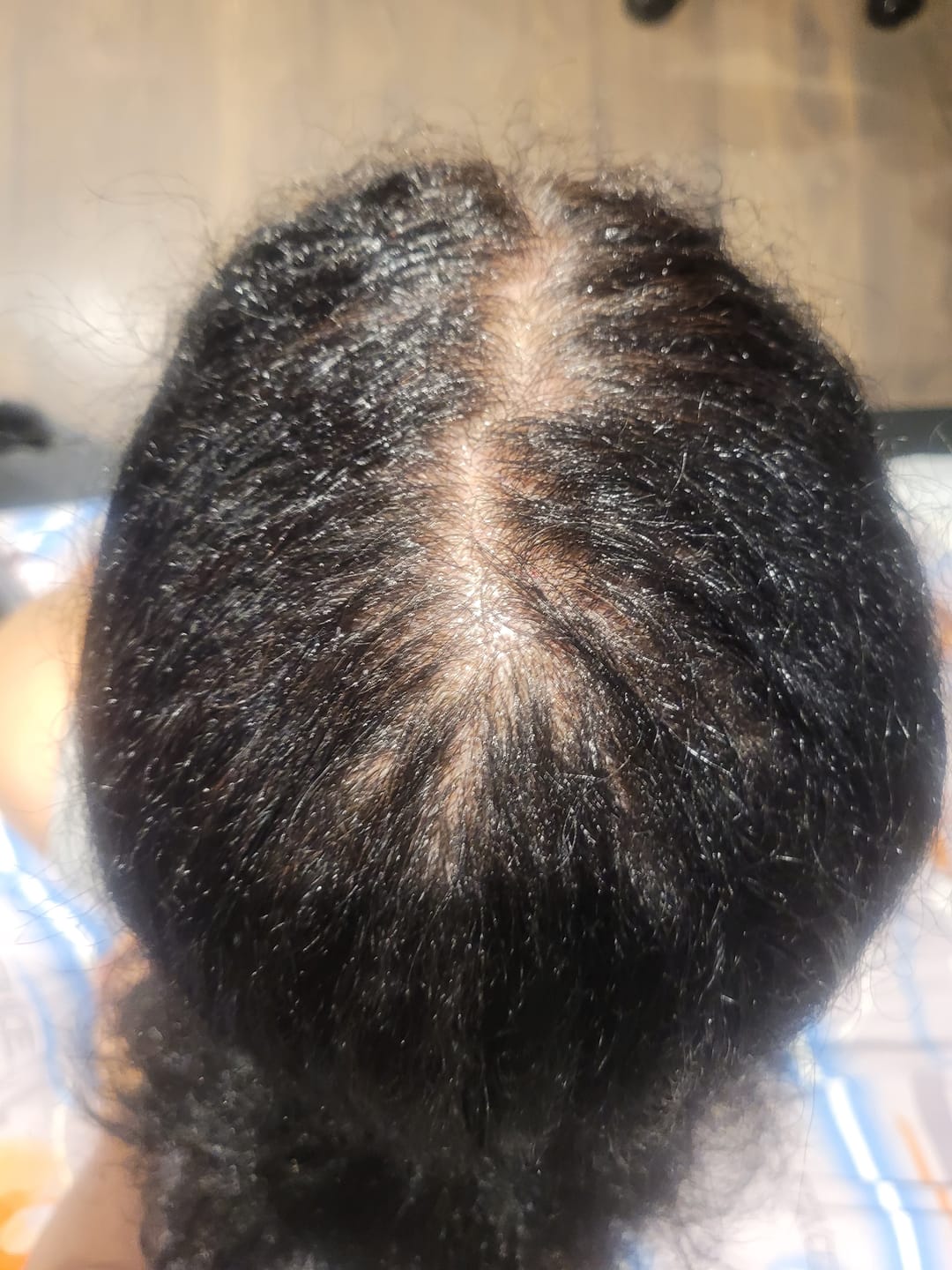 Customer photo review of Nourish & Shine Hair Oil