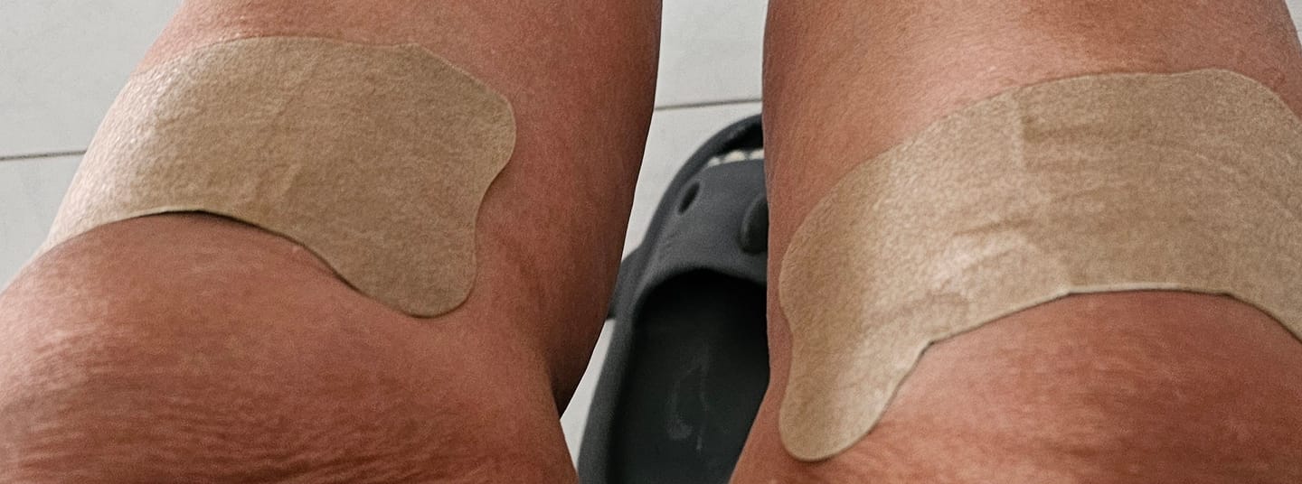 Customer photo review of Auxilium Joint Patches (fka "Heaven Patch")