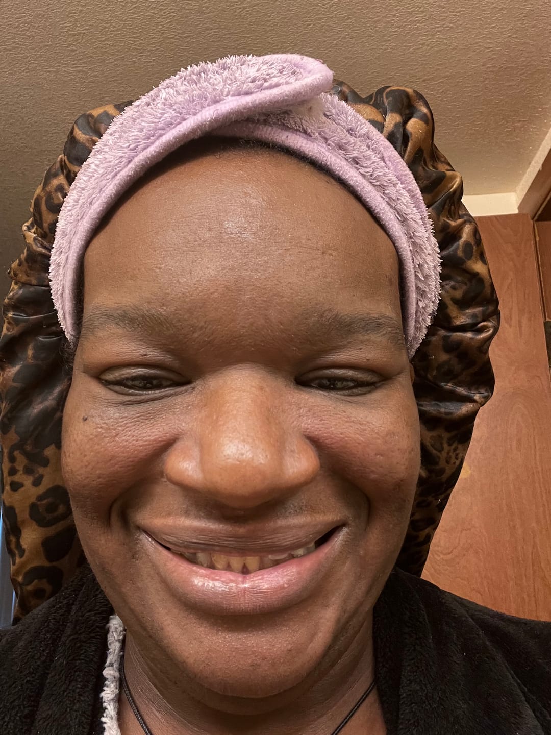 Customer photo review of Turmeric and Kojic Foaming Face Wash