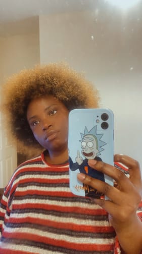 Customer photo review of Anti-Acne & Dark Spots African Soap