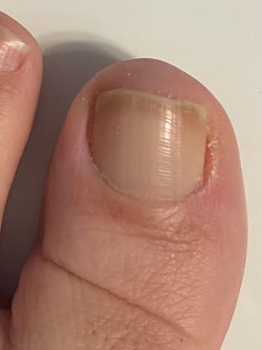 Customer photo review of Lanbena Nail Repair Essence Serum