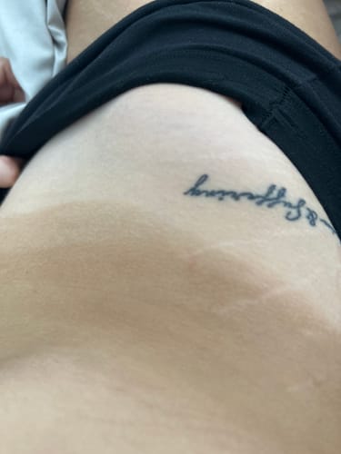 Customer photo review of Lusso Self-Tanning Mousse