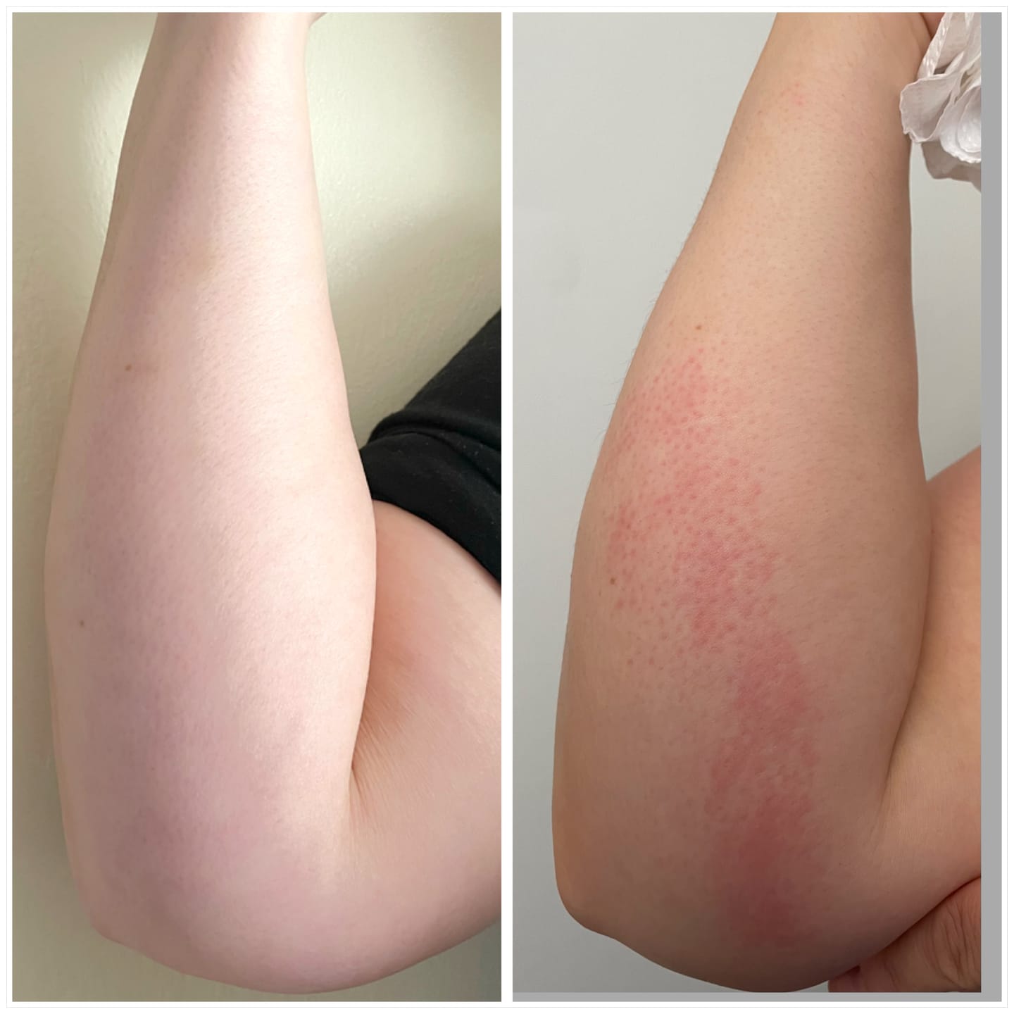 Customer photo review of Repair & Renew Cream