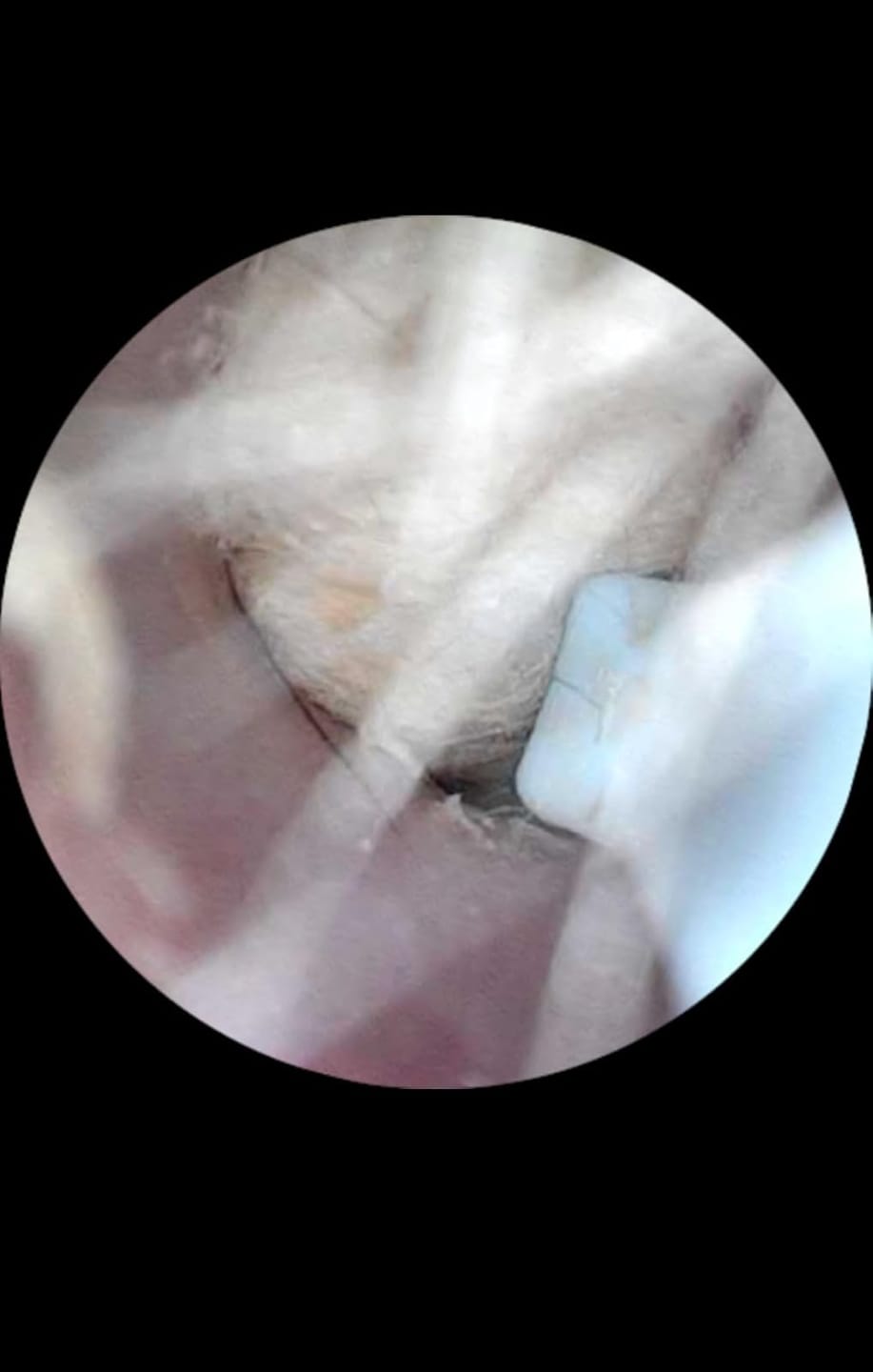 Customer photo review of Slivor VisioEar: Doctor Approved Ear Health Technology
