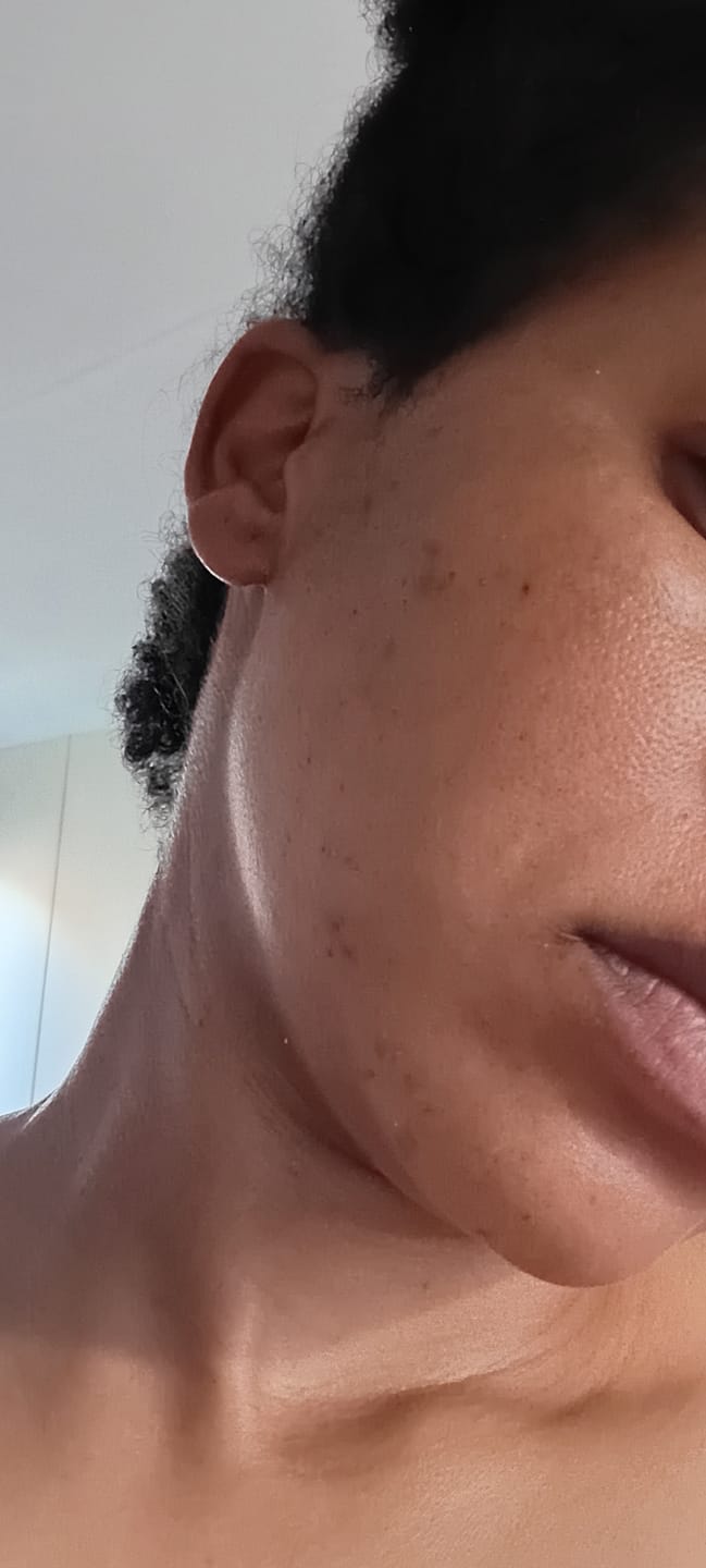 Customer photo review of Gmaeum Peptides Face Cream (50g)