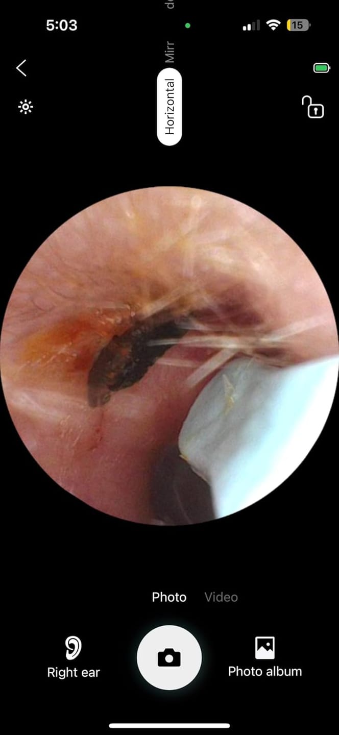 Customer photo review of Slivor VisioEar: Doctor Approved Ear Health Technology