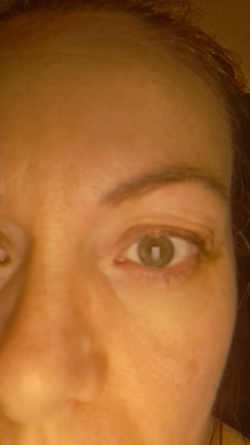 Customer photo review of Luxe Wimpernlifting Set (Kaufe 1 und erhalte 1 gratis dazu)