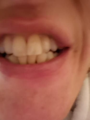 Customer photo review of Advanced Dental Water Flosser (with UV light) + Concentrated Mouthwash