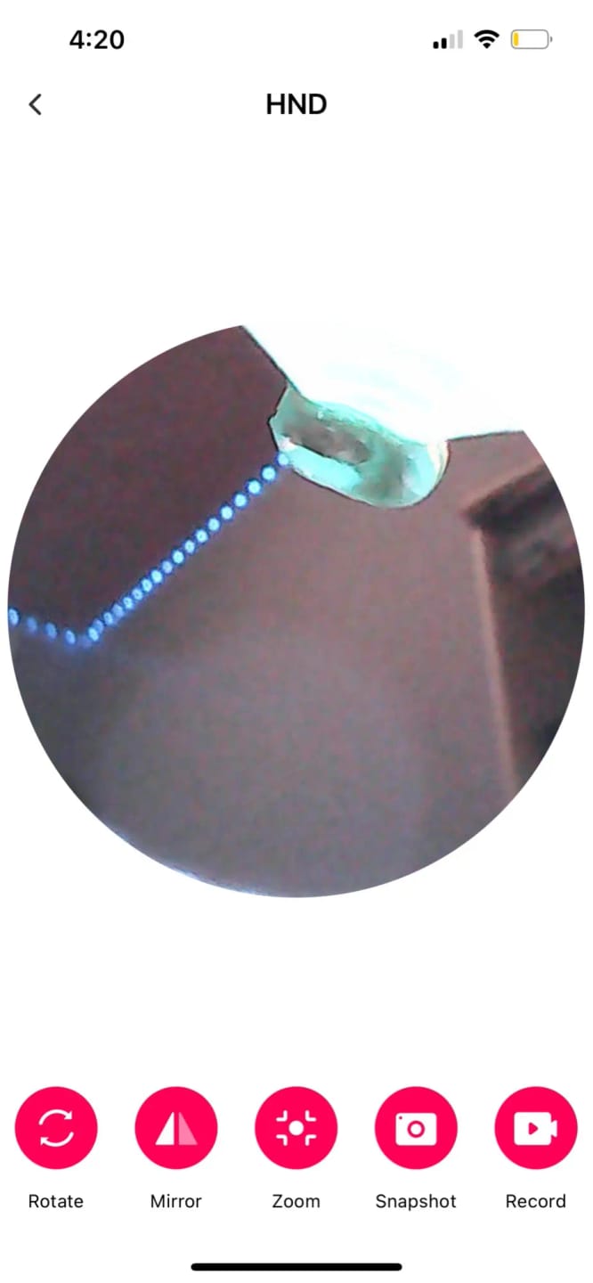 Customer photo review of EasyEar™ by Hyge