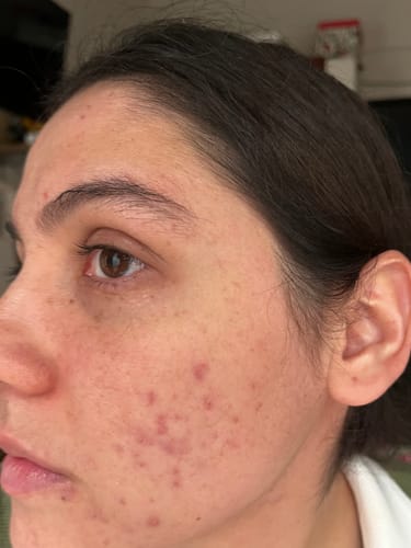 Customer photo review of Formula Personalizada (Rx)