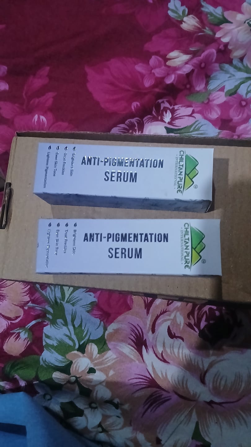Customer photo review of Anti-Pigmentation Serum – Brighten Skin, Lighten Pigmentation, Fade Freckles & Even Skin Tone 30ml