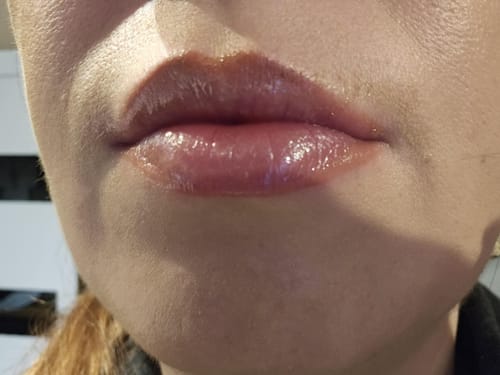 Customer photo review of SUPREME LIPS POWIĘKSZACZ DO UST