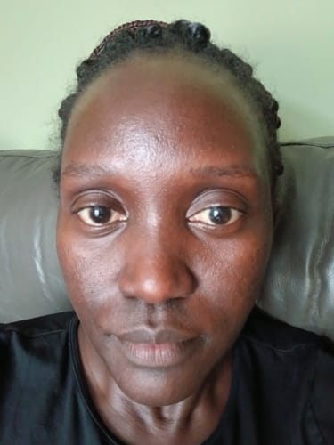 Customer photo review of Anti-Acne & Dark Spots African Soap