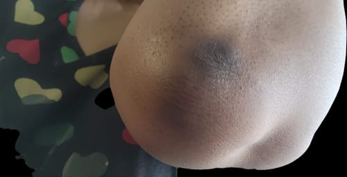 Customer photo review of Glass Skin Face Kit