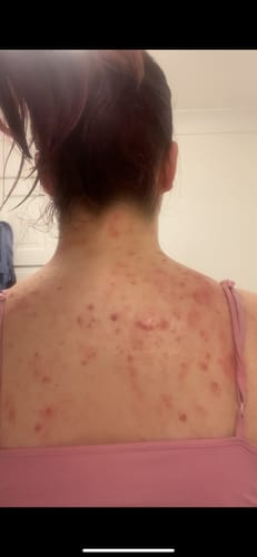 Customer photo review of The Soothe Blend