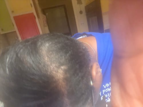 Customer photo review of Healthy Hair Starter Kit- Limited Edition