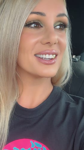 Customer photo review of PRISM (GOLD PLATED GRILLZ)
