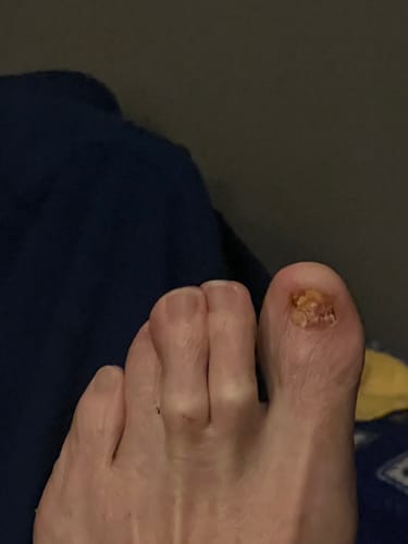 Customer photo review of Shipping Protection