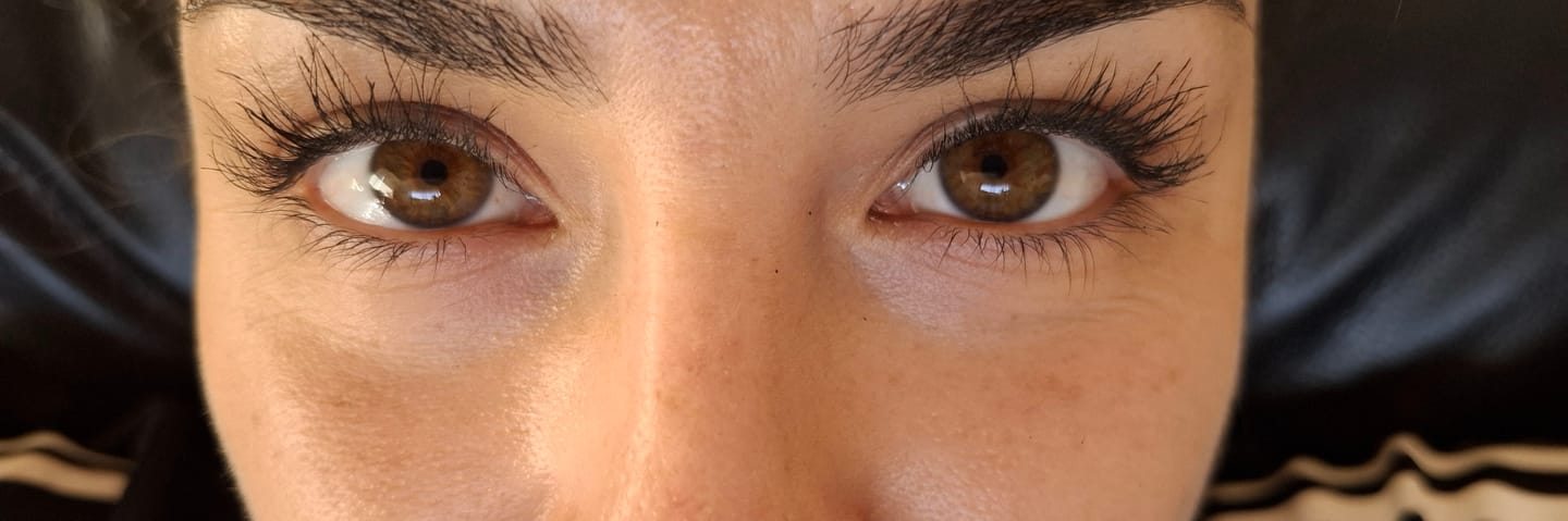 Customer photo review of Flash Serum Para Crecimiento de las Pestañas 2 ml