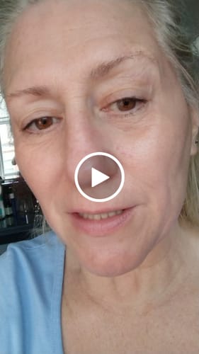 Customer video review of Glov Micro Infusion System