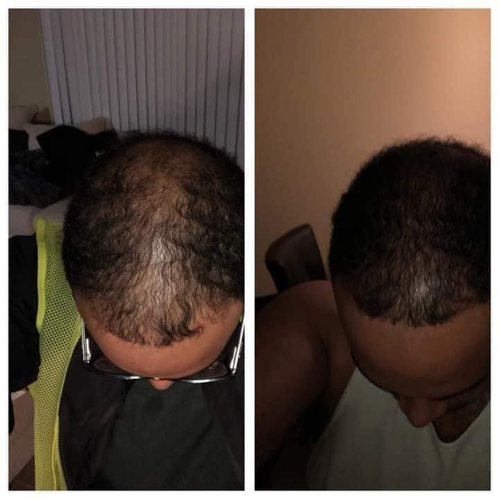 Customer photo review of The Rich Royals Healthy Hair Growth Supplement