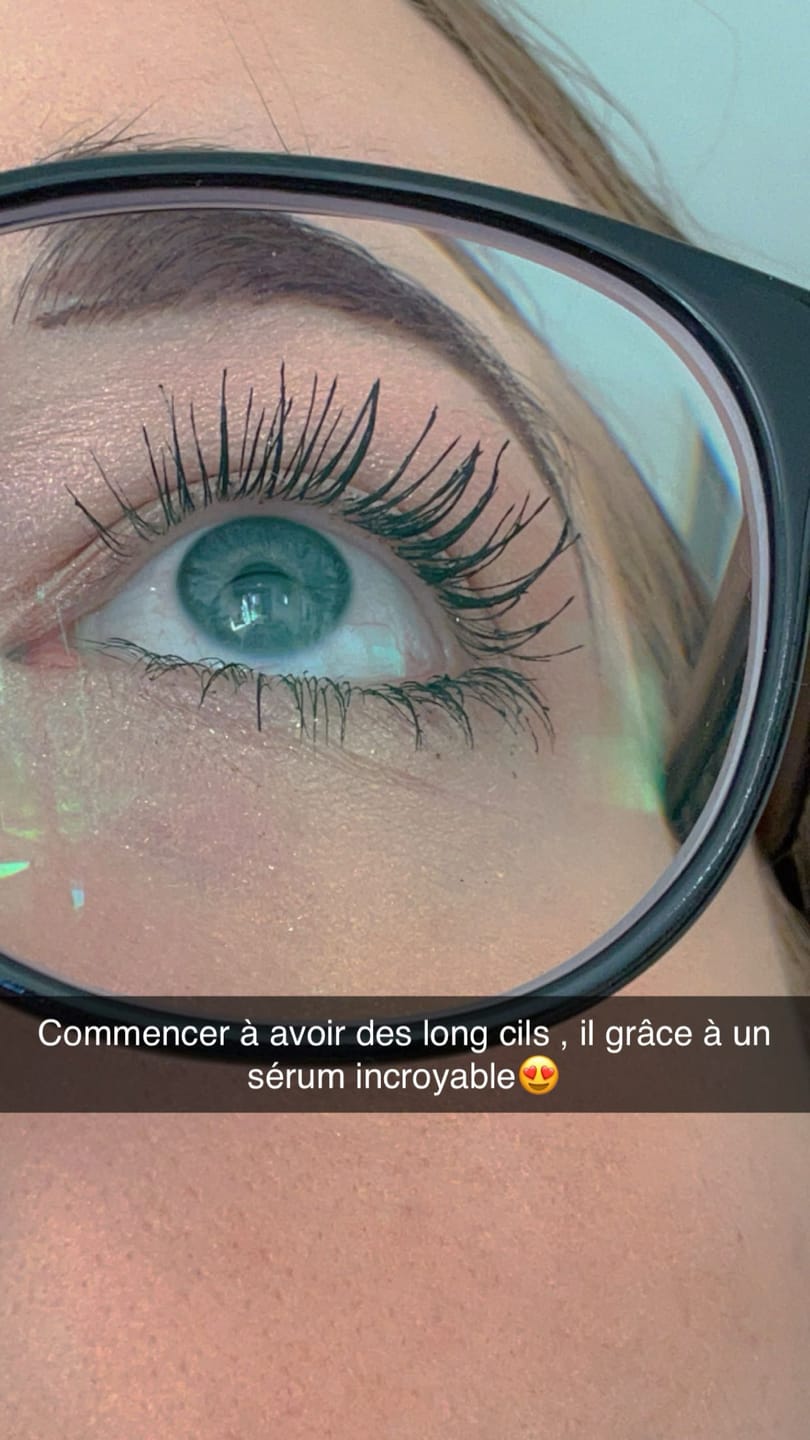 Customer photo review of SÉRUM DE CROISSANCE POUR CILS