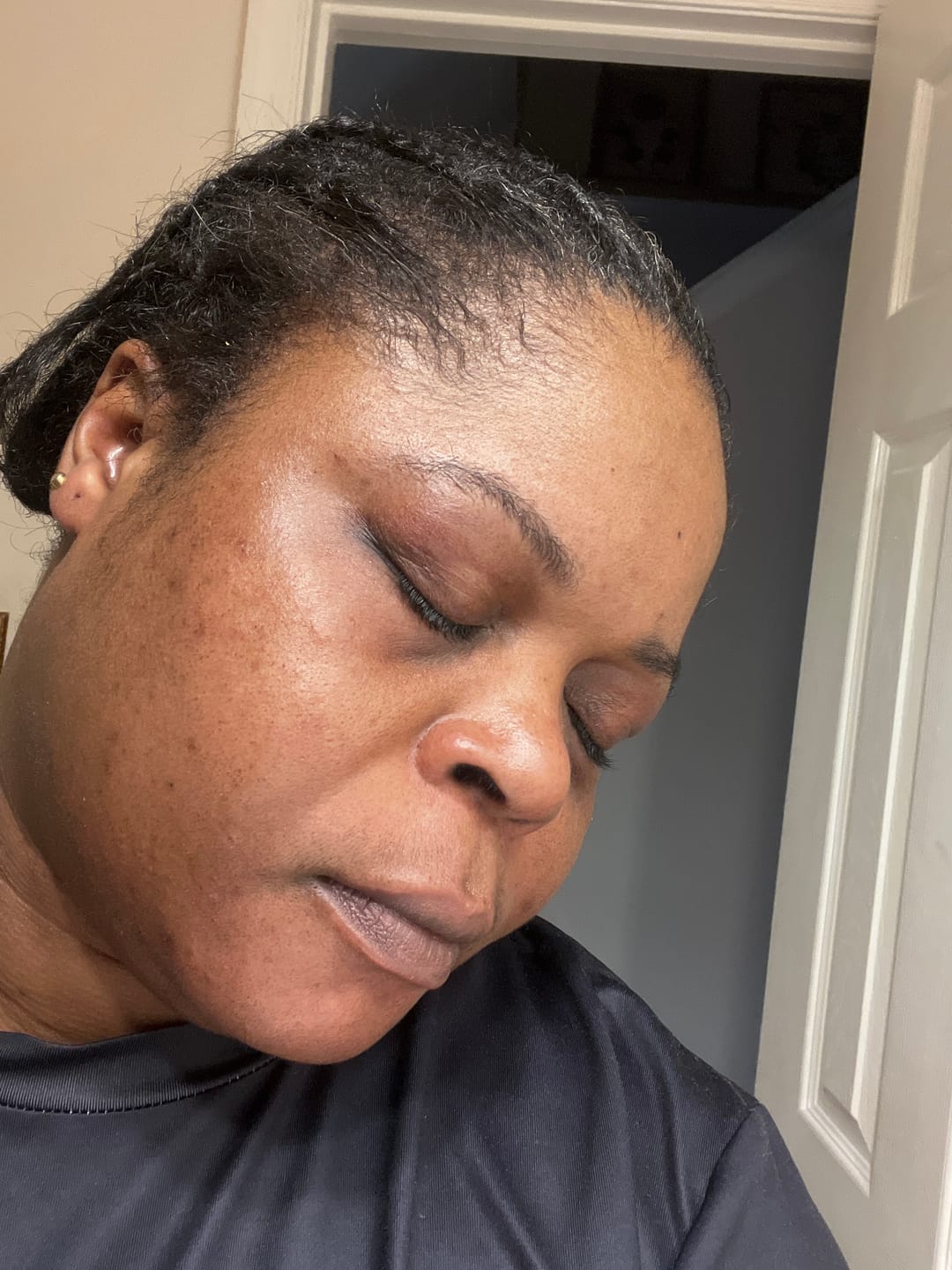 Customer photo review of Intense Discoloration Treatment (Rapid Action)