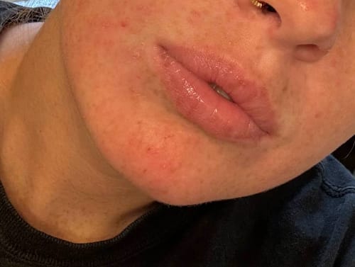 Customer photo review of Zorla™ Turmeric Brightening Glow Face Wash