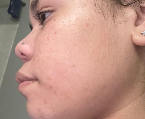 Customer photo review of Zorla™ Turmeric Brightening Glow Face Wash