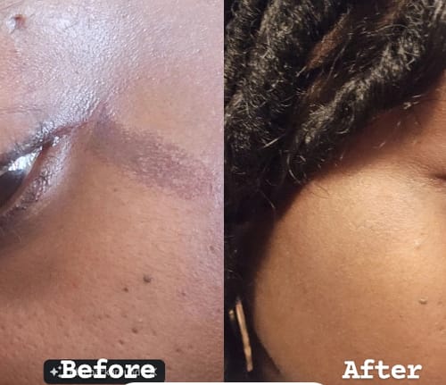 Customer photo review of Zorla™ Turmeric Brightening Glow Face Wash