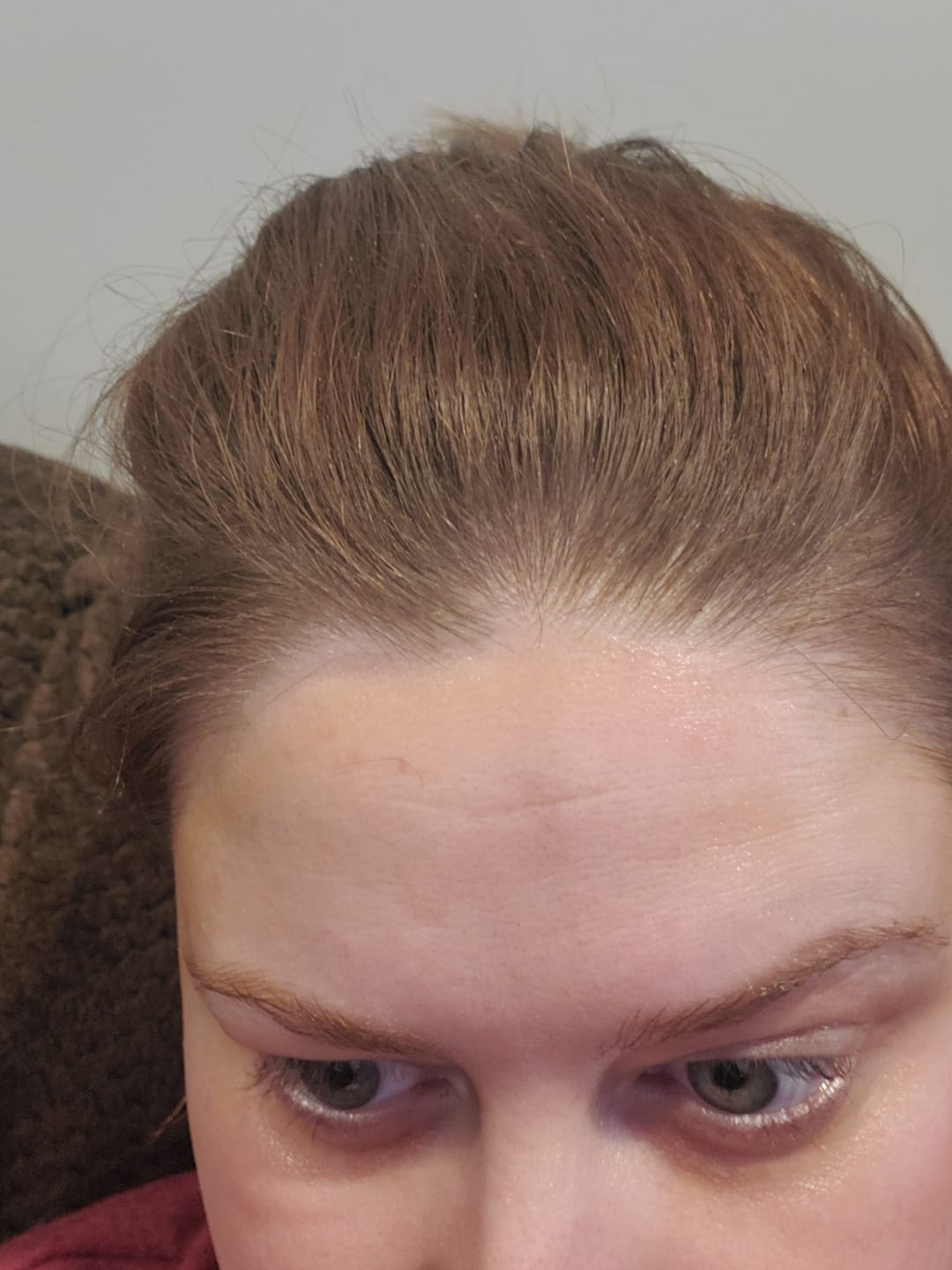 Customer photo review of Magic Wrinkle Eraser Night Balm