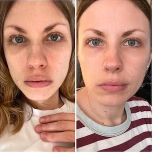 Customer photo review of Vitamin C Serum + Sculpting Serum