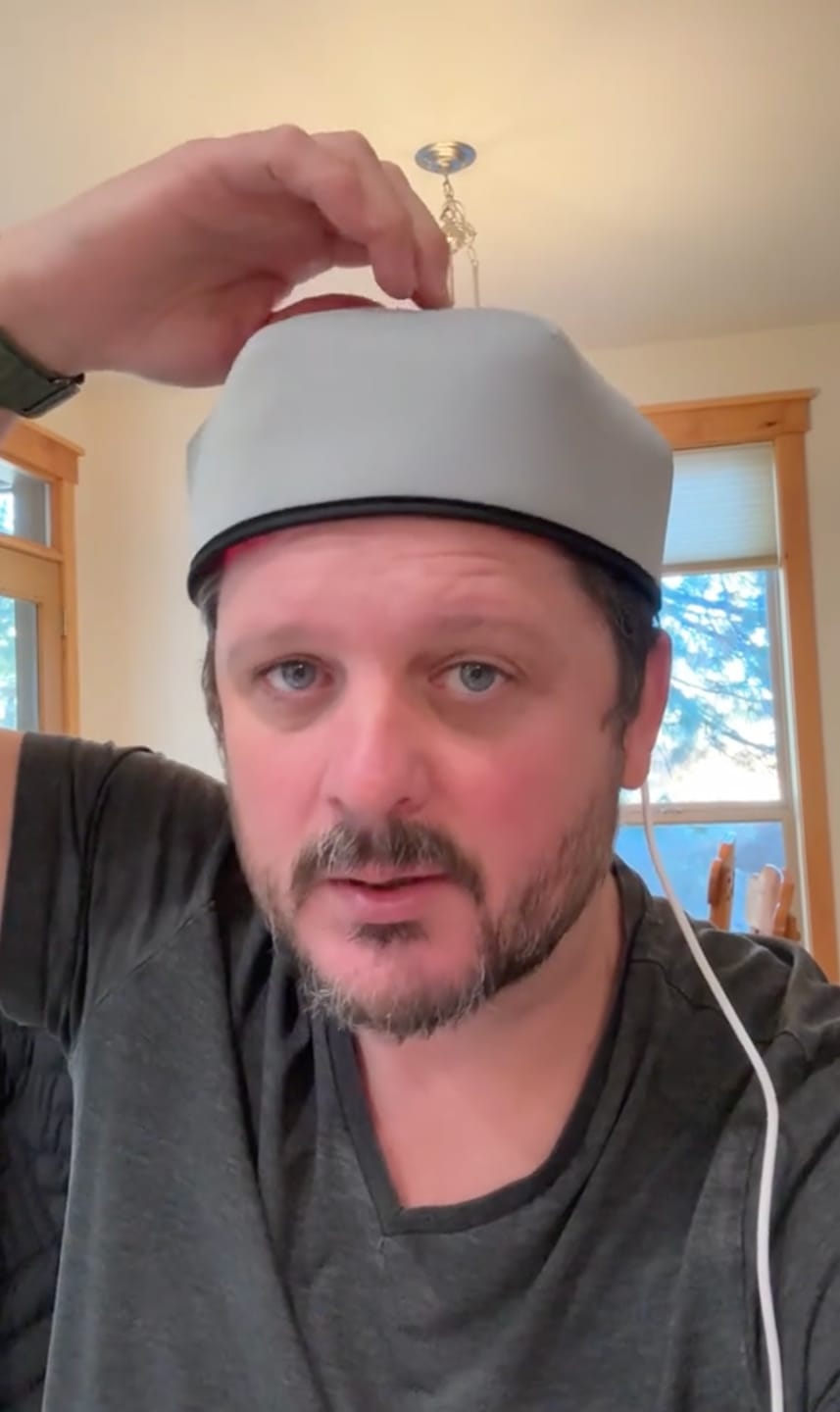 Customer photo review of Nicebeam Red Light Therapy Hat