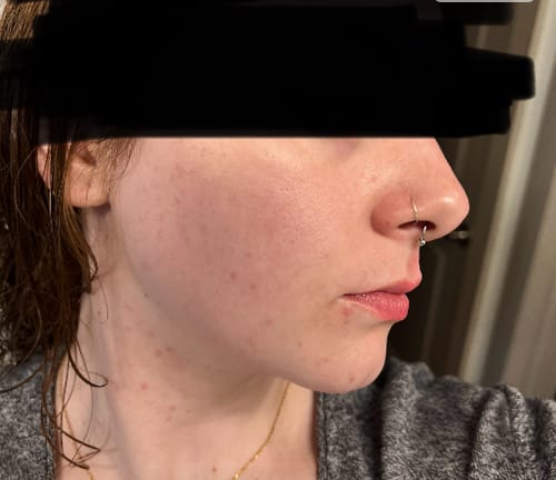 Customer photo review of Zorla™ Turmeric Brightening Glow Face Wash