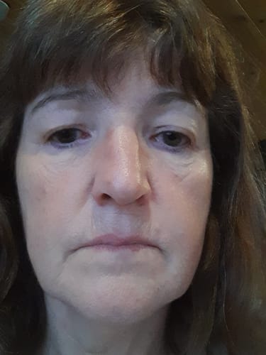 Customer photo review of The Naked Skin Bio-Collagen Mask