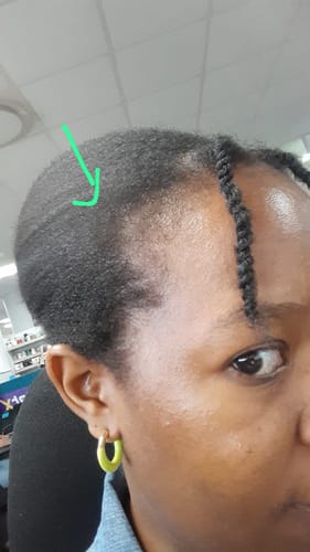 Customer photo review of All-In-One Hair Oil (200ml)