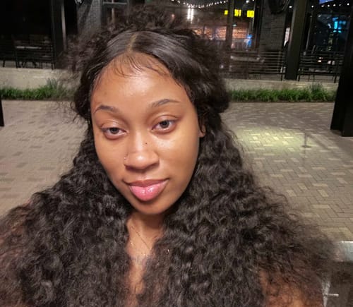 Customer photo review of Zorla™ Turmeric Brightening Glow Face Wash