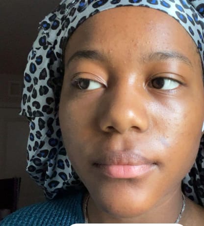 Customer photo review of Zorla™ Turmeric Brightening Glow Face Wash